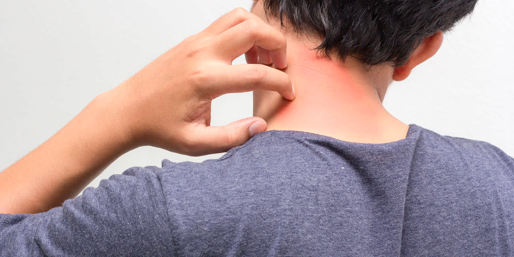 guy itching his neck